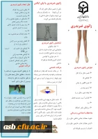 زانوی ضریدری یا پای ایکس