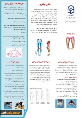 زانوی پرانتزی