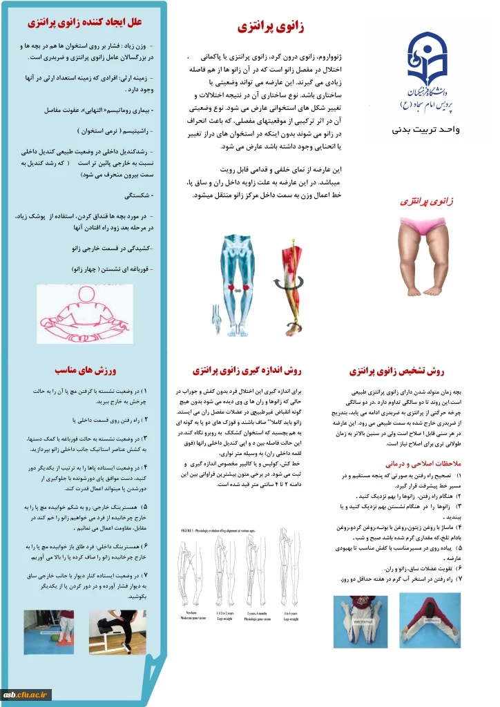 زانوی پرانتزی 2